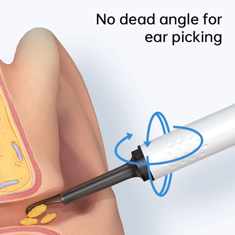 Smart Visual Ear Pick